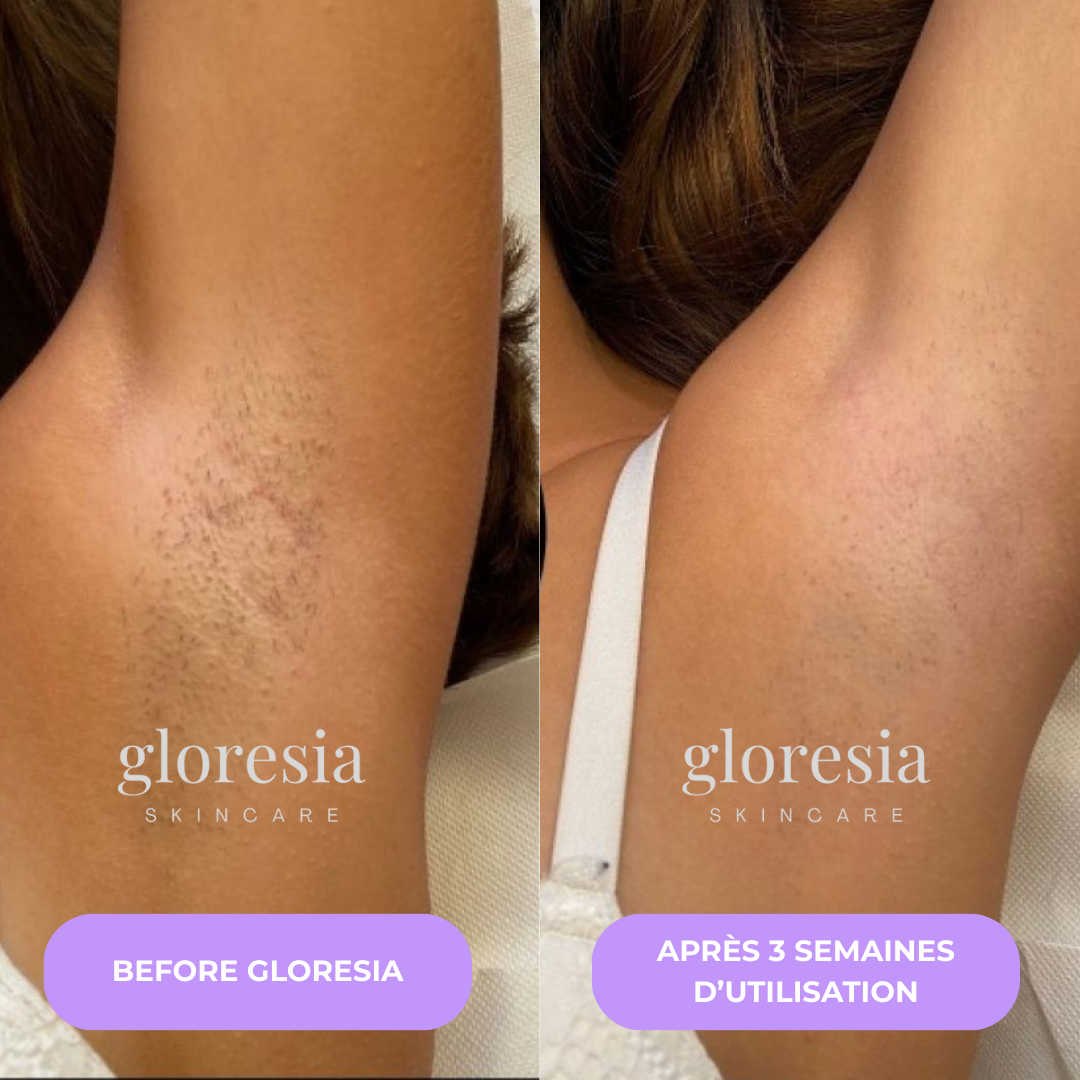 Gloresia™ – Sérum Anti-Repousse Naturel