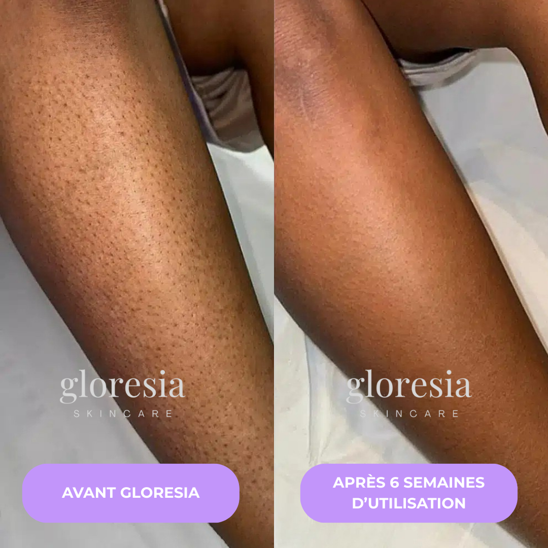 Gloresia™ – Sérum Anti-Repousse Naturel