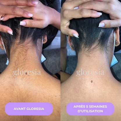 Gloresia™ | Sérum Anti-Repousse Naturel